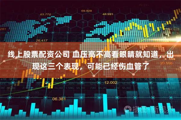 线上股票配资公司 血压高不高看眼睛就知道，出现这三个表现，可能已经伤血管了